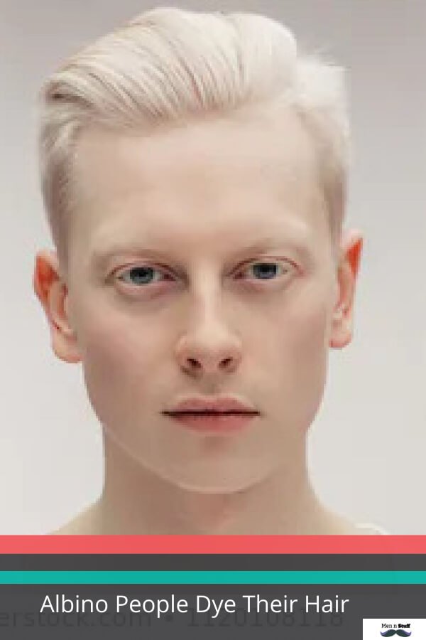 Albino People Dye Their Hair